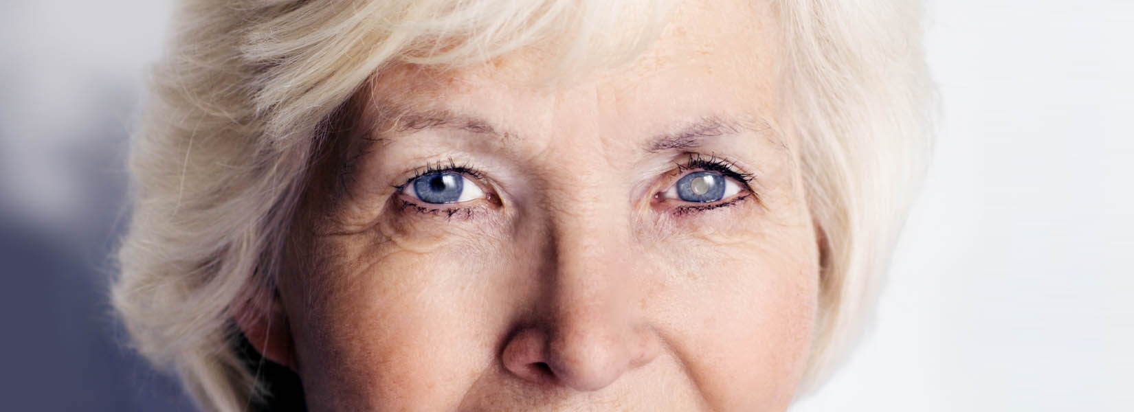 Cataract Surgery in Clarksville
